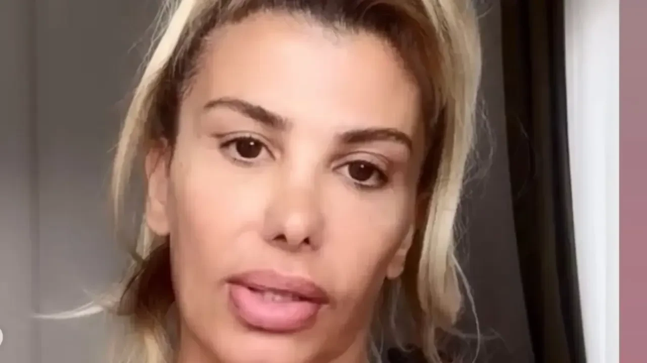 Şarkıcı Hatice'nin Botoks Krizi: Sağlık Durumunu Konuştu!