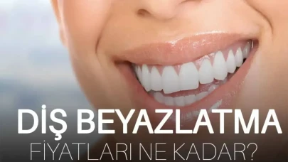 10 Soruda Diş Beyazlatma Yolları, Dişler ne kadar beyazlar?
