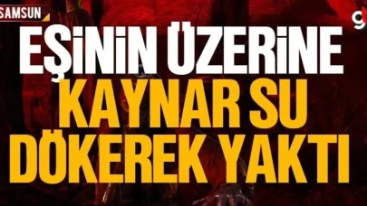 Samsun'da eşinin üzerine kaynar su dökerek yakan koca yakalandı