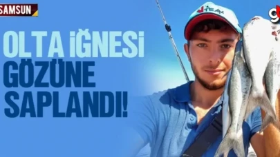 Olta iğnesi gözüne saplandı