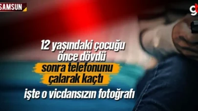 12 Yaşındaki Çocuğu Döverek Elindeki Telefonu Çalarak Kaçtı