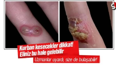 Kurban kesecekler dikkat! Orf hastalığı virüsü nedir?