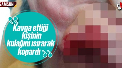 Samsun'da kavga ettiği kişinin kulağını ısırarak kopardı