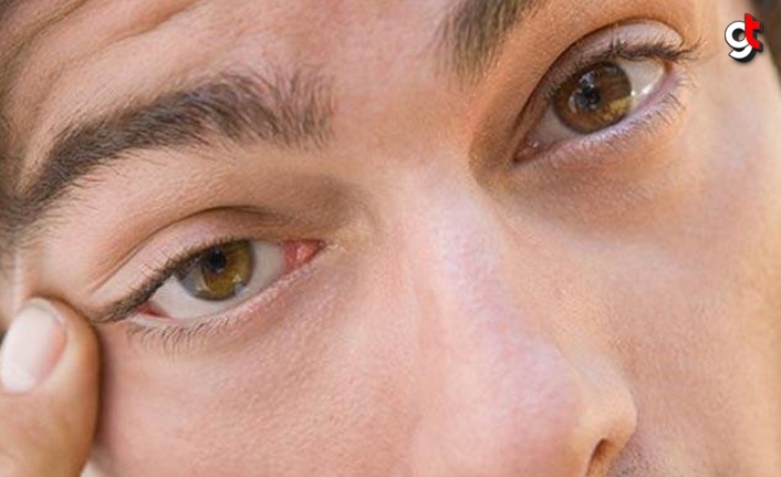 Sol ve sağ göz kapağı seyirmesi hangi hastalığın belirtisidir, tedavisi nasıl?
