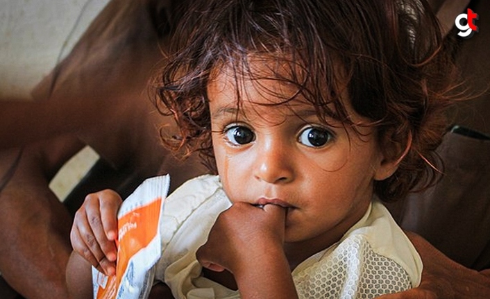 UNICEF: 8 milyon çocuk açlıktan ölmek üzere